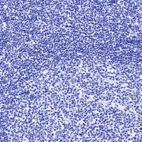 Progesterone Receptor Recombinant Rabbit mAb,PBS Only (SDT-R123)