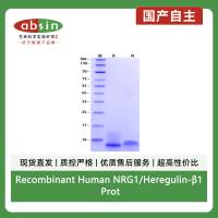 Recombinant Human NRG1/Heregulin-β1 Protein