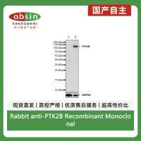 Rabbit anti-PTK2B Recombinant Monoclonal Antibody(S-2417-80)
