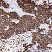 Rabbit anti-YB1 Recombinant Monoclonal Antibody(S-1748-144)