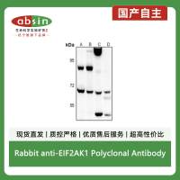 Rabbit anti-EIF2AK1 Polyclonal Antibody
