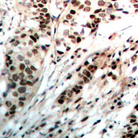 Rabbit anti-Progesterone Receptor Polyclonal Antibody
