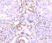 Rabbit anti-Phospho-Erk1(T202)+Erk2(T185) Monoclonal Antibody