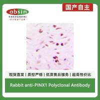 Rabbit anti-PINX1 Polyclonal Antibody