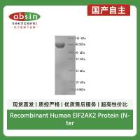Recombinant Human EIF2AK2 Protein (N-terminal 6xHis)