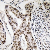 Rabbit anti-PMS2 Polyclonal Antibody
