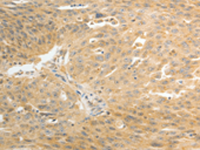 Rabbit anti-AKR1C1 Polyclonal Antibody