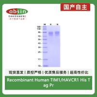 Recombinant Human TIM1/HAVCR1 His Tag Protein(His Tag)
