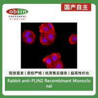 Rabbit anti-PLIN2 Recombinant Monoclonal Antibody