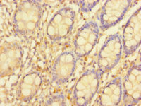 Rabbit anti-SGTB Polyclonal Antibody