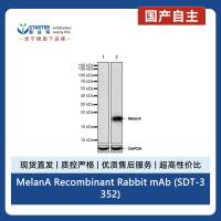 MelanA Recombinant Rabbit mAb (SDT-3352)