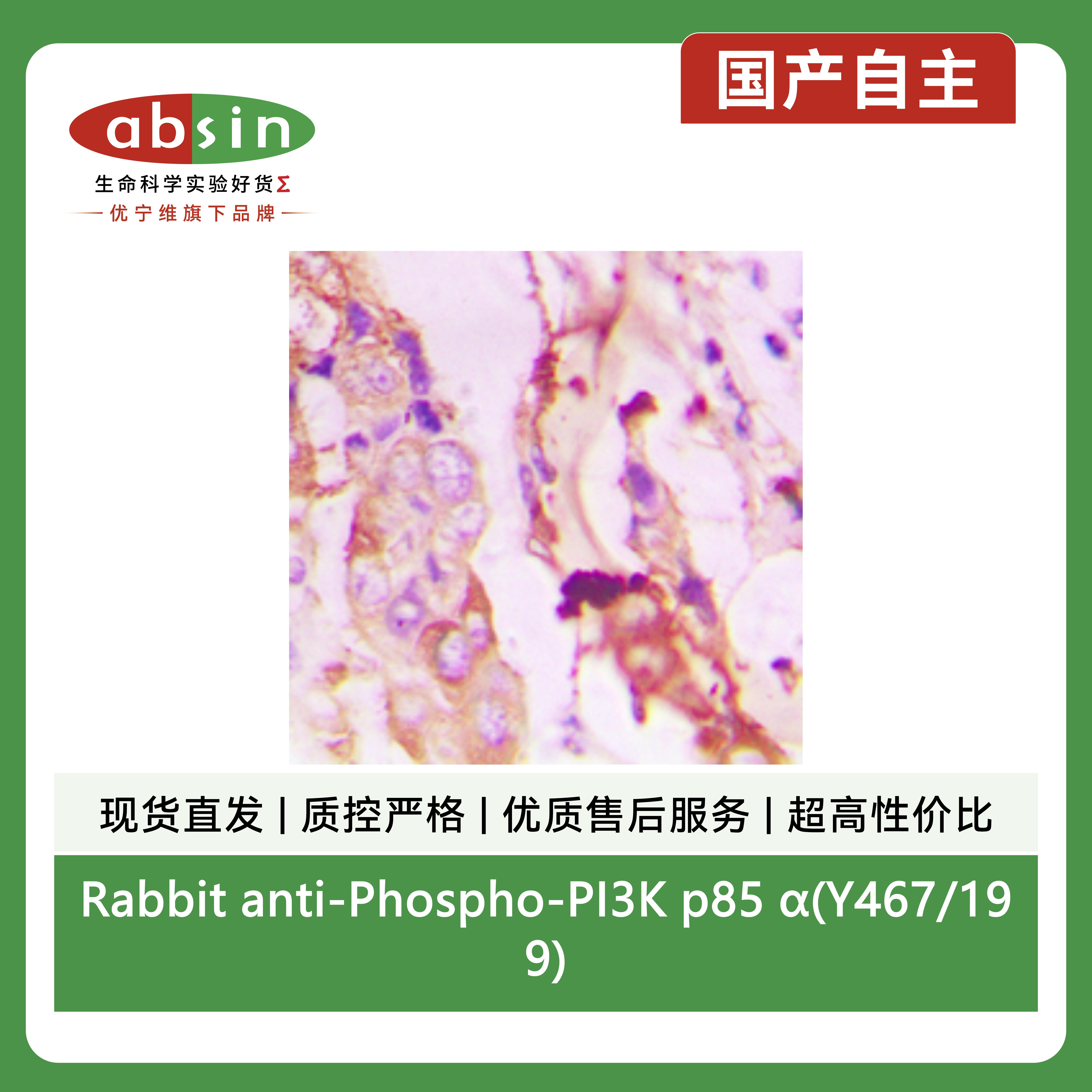 Rabbit anti-Phospho-PI3K p85 α(Y467/199) Polyclonal Antibody产品图