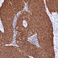 S-RMab® CK-HMW Recombinant Rabbit mAb (SDT-P002)