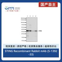 STING Recombinant Rabbit mAb (S-1392-33)