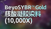 新品推送｜BeyoSYBR™ Gold核酸凝胶染料：让核酸电泳从“将就”到“讲究”