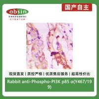 Rabbit anti-Phospho-PI3K p85 α(Y467/199) Polyclonal Antibody