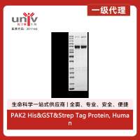 PAK2 His&GST&Strep Tag Protein, Human