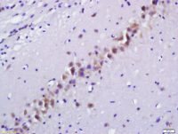 Rabbit anti-CGRP Polyclonal Antibody