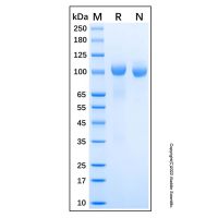 Recombinant Human Tie-2 Protein，无动物源,无载体,His标签,PBS Only,≥95%(SDS-PAGE)，阿拉丁