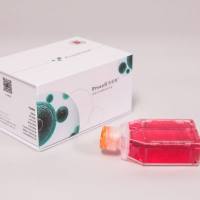 Reh（人急性非B非T淋巴细胞白血病）（STR鉴定正确）_货号:CL-0484
