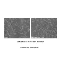 Recombinant Human CRELD1 Protein，无动物源,无载体,生物活性,ActiBioPure™,高性能,His标签,≥95%(SDS-PAGE),expressed in HEK293; 见COA，阿拉丁