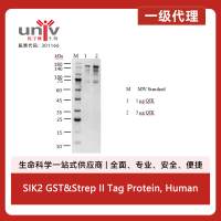SIK2 GST&Strep II Tag Protein, Human