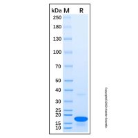 Recombinant Human TRBC1 Protein,无载体, His标签, ≥95%(SDS-PAGE), expressed in E. coli; 见COA,阿拉丁