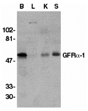 ProSci热销产品推荐：GFR alpha 1 Antibody【1133】