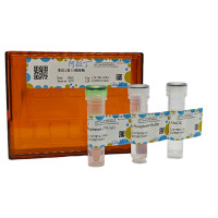 重组λ蛋白磷酸酶,401941-75-1,无动物源, 生物活性, ActiBioPure™, EnzymoPure™, ≥95%, 70 U/μL,阿拉丁