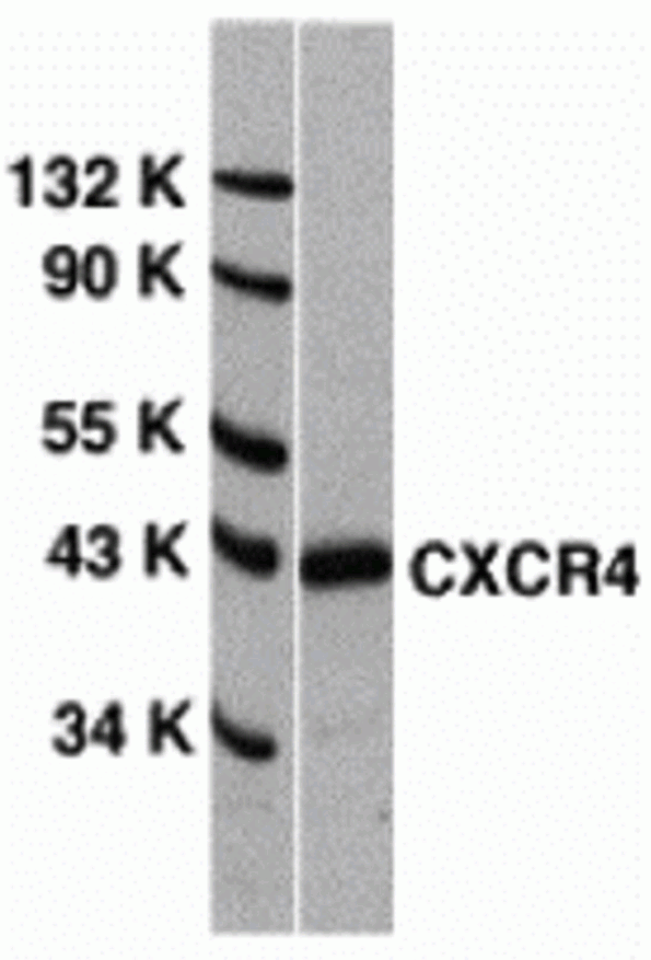 ProSci热销产品推荐 — CXCR4 Antibody【1009】