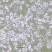 人横纹肌肉瘤(依据分子特征重分类为尤文肉瘤家族肿瘤)细胞)RH-1细胞