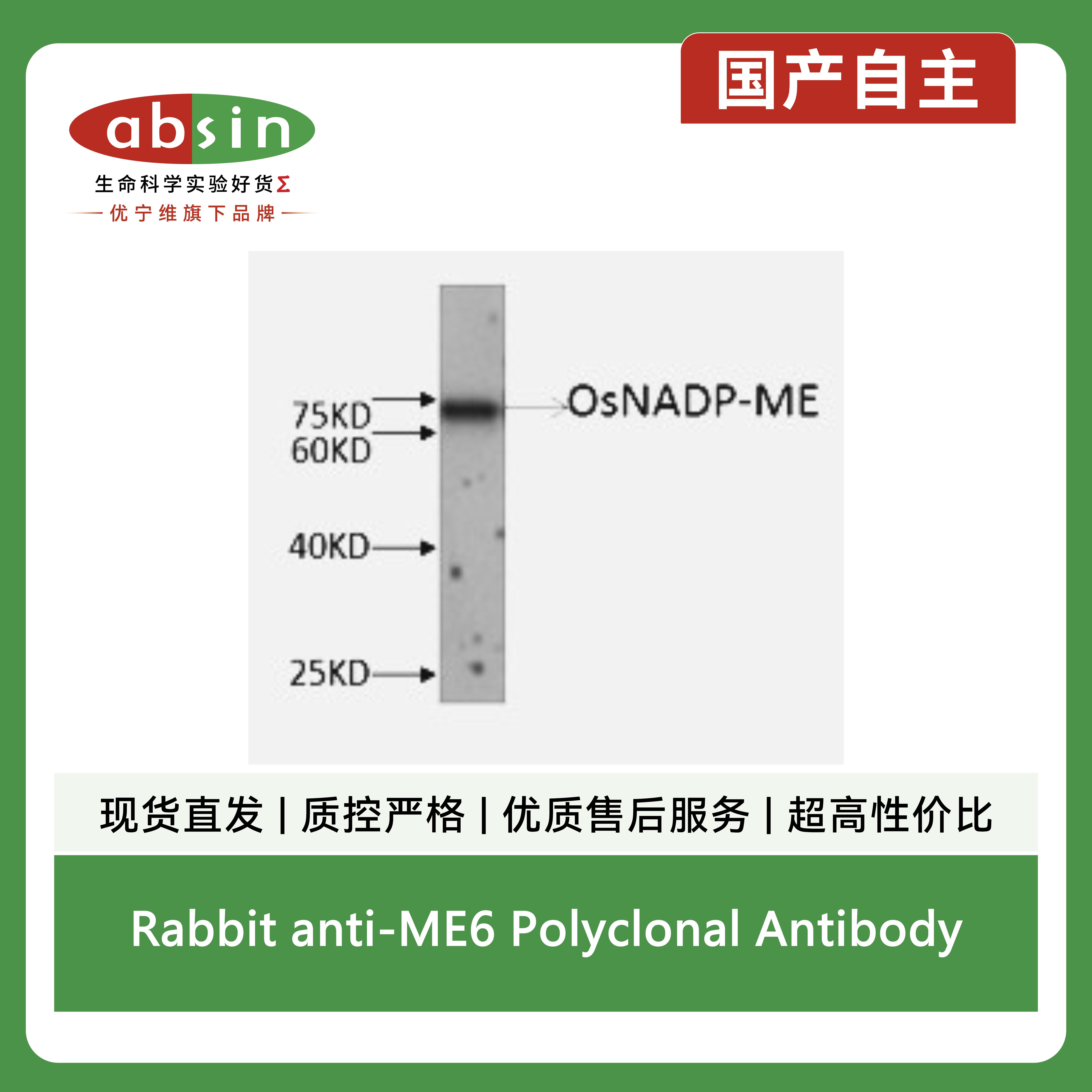 Rabbit anti-ME6 Polyclonal Antibody产品图