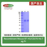 Recombinant Mouse B7-H3/CD276 His Tag Protein(His Tag)