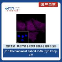 p16 Recombinant Rabbit mAb (Cy5 Conjugate) (S-303-1)