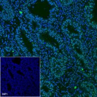 Estrogen Receptor α Recombinant Rabbit mAb (Alexa Fluor® 488 Conjugate) (SDT-R371)