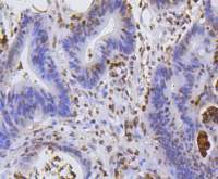 Rabbit anti-Hydroxyl-Histone H2A(Tyr39) Monoclonal Antibody(SR4-17)