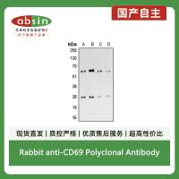 Rabbit anti-CD69 Polyclonal Antibody