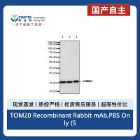 TOM20 Recombinant Rabbit mAb,PBS Only (SDT-2553-11)