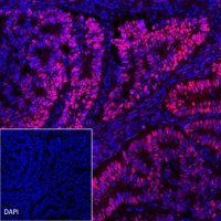 Progesterone Receptor Recombinant Rabbit mAb (Alexa Fluor® 555 Conjugate) (SDT-R123)