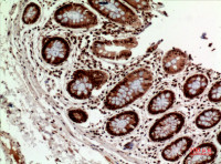 Rabbit anti-HLA DQB1/2 Polyclonal Antibody
