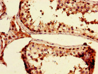 Rabbit anti-PRDM4 Polyclonal Antibody