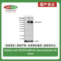 Rabbit anti-BCRP/ABCG2 Recombinant Monoclonal Antibody(S-2365-67)