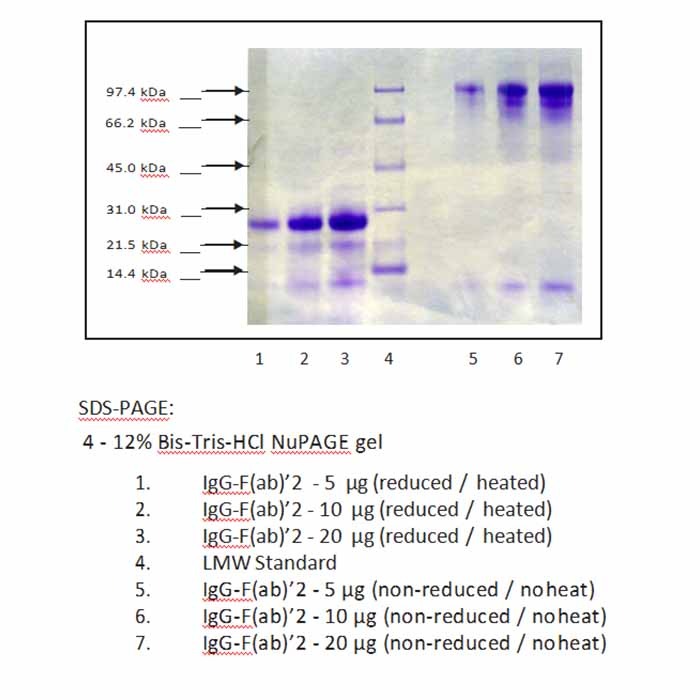 免疫球蛋白G (IgG), F (ab')₂片段 来源于人血浆,天然, ≥95%(SDS-PAGE), 蛋白浓度见COA,阿拉丁