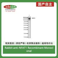 Rabbit anti-NFAT1 Recombinant Monoclonal Antibody(S-1797-224)