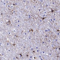 GFAP Recombinant Mouse mAb,PBS Only (SDT-3032)