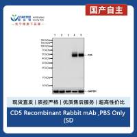 CD5 Recombinant Rabbit mAb ,PBS Only (SDT-2857-16)