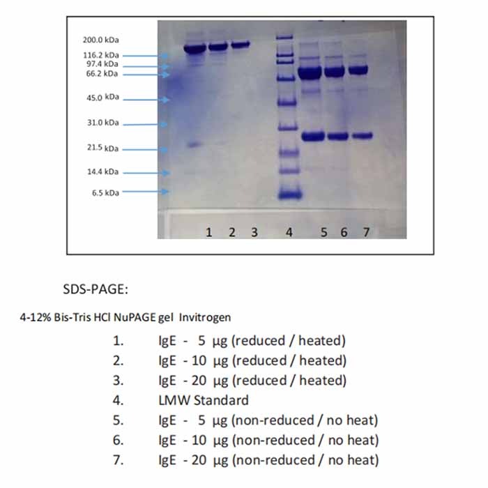 免疫球蛋白E(IgE),人骨髓瘤血浆,Lambda,天然, ≥95%(SDS-PAGE), 蛋白浓度见COA,阿拉丁