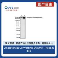 Angiotensin Converting Enzyme 1 Recombinant Rabbit mAb ,PBS Only(SDT-2662-122)