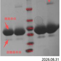 100μg 人中性粒细胞载脂蛋白 ; Human neutrophil lipocalin;HNL抗原