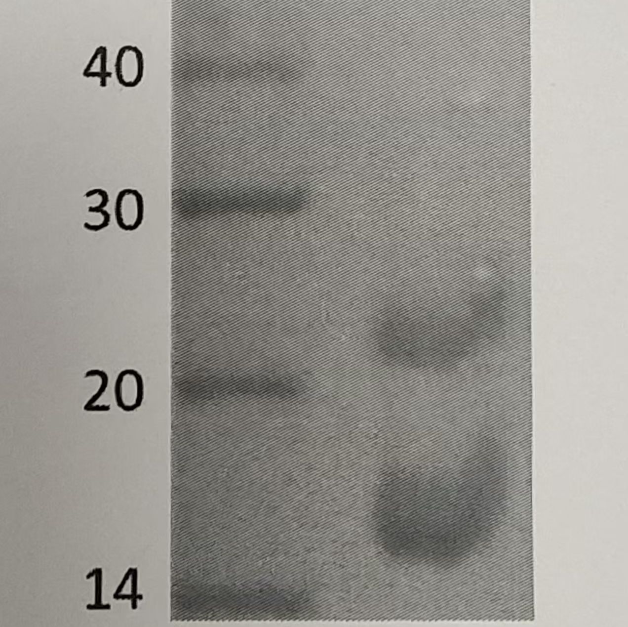 100μg 促甲状腺激素(TSH);促甲状腺激素;TSH-Ag